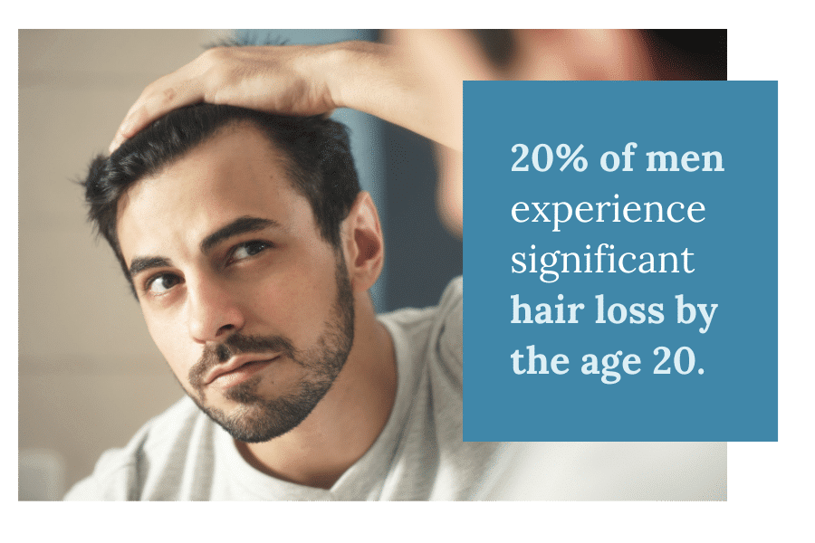 Male hair loss graphic